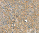 Anti-Human/Rat SLC8A3 Antibody - ABMIUM