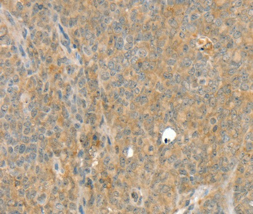 Anti-Human/Rat SLC8A3 Antibody - ABMIUM