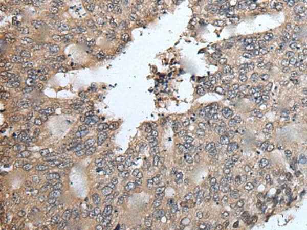 Anti-Human/Mouse/Rat TRIM23 Antibody