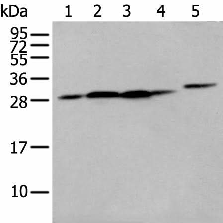 Western blot analysis of 293T cell Human fetal liver tissue A549 and Hepg2 cell using FKBP7 Polyclonal Antibody at dilution of 1:400