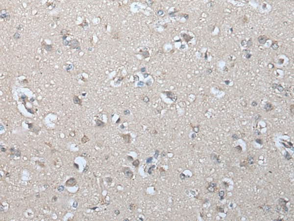 Immunohistochemistry of paraffin-embedded Human brain tissue using IFNB1 Polyclonal Antibody at dilution of 1:45(×200)