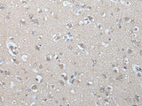 Immunohistochemistry of paraffin-embedded Human brain tissue using IFNB1 Polyclonal Antibody at dilution of 1:45(×200)