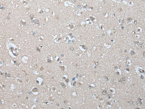 Immunohistochemistry of paraffin-embedded Human brain tissue using IFNB1 Polyclonal Antibody at dilution of 1:45(×200)
