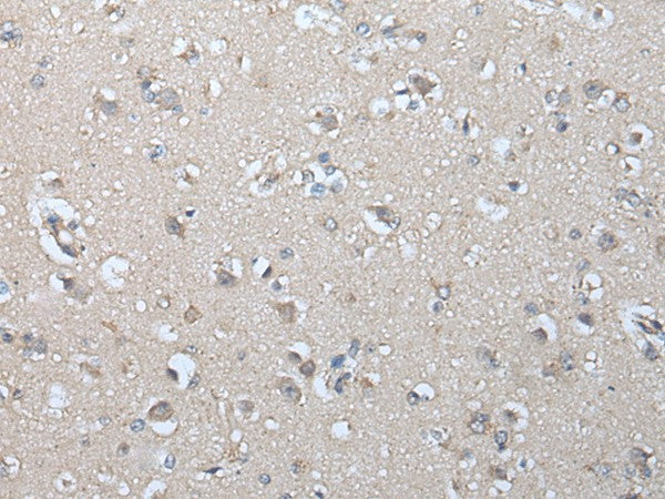 Immunohistochemistry of paraffin-embedded Human brain tissue using IFNB1 Polyclonal Antibody at dilution of 1:45(×200)