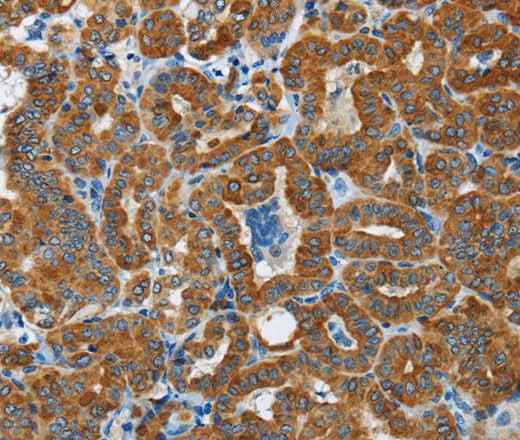 Anti-Human/Mouse/Rat FLCN Antibody