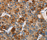 Anti-Human SLAMF8 Antibody - ABMIUM