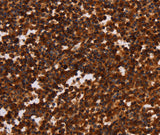 Anti-Human/Mouse ALG11 Antibody - ABMIUM