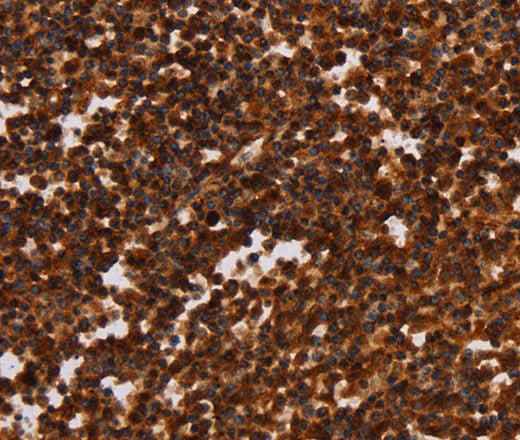 Anti-Human/Mouse ALG11 Antibody