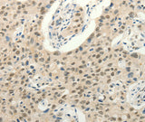 Anti-Human/Mouse FZD10 Antibody - ABMIUM