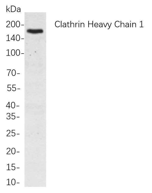 Anti-Human/Mouse/Rat Clathrin Heavy Chain Antibody [B801] - ABMIUM