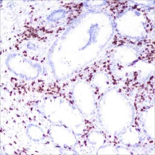 Anti-Human CD2 Antibody [A164] - ABMIUM