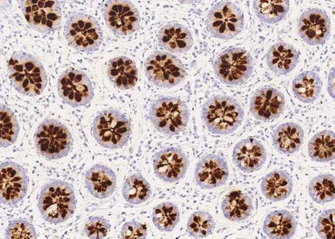 Anti-Human REG4 Antibody [B144] - ABMIUM