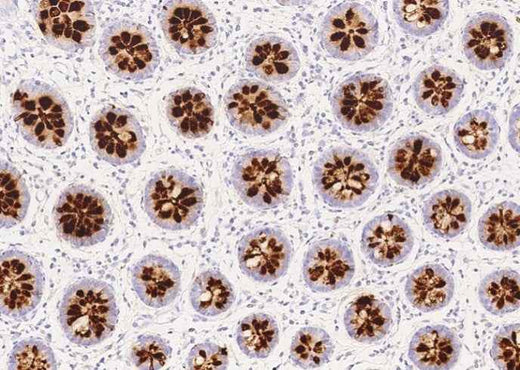 Anti-Human REG4 Antibody [B144] - ABMIUM