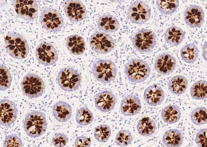 Anti-Human REG4 Antibody [B144]