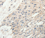 Anti-Human/Mouse SLC9A7 Antibody - ABMIUM