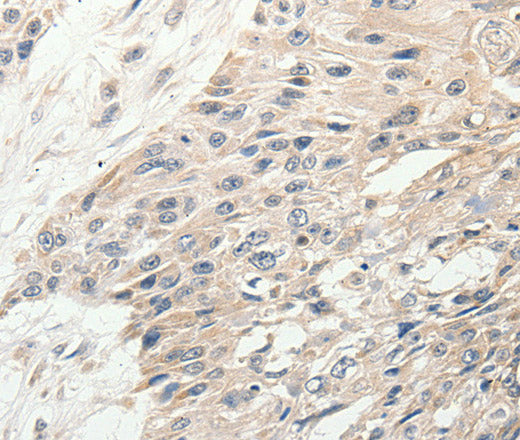 Anti-Human/Mouse SLC9A7 Antibody - ABMIUM