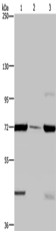 Anti-Human/Mouse/Rat FAAH Antibody - ABMIUM