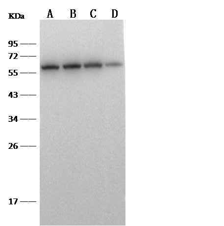 Anti-Human CD5 Antibody [A1113] - ABMIUM
