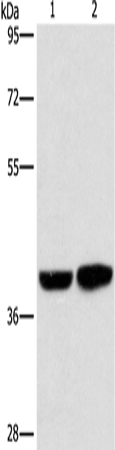 Anti-Human/Mouse CAB39L Antibody - ABMIUM