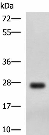 Western blot analysis of MCF7 cell lysate using DHRS2 Polyclonal Antibody at dilution of 1:750