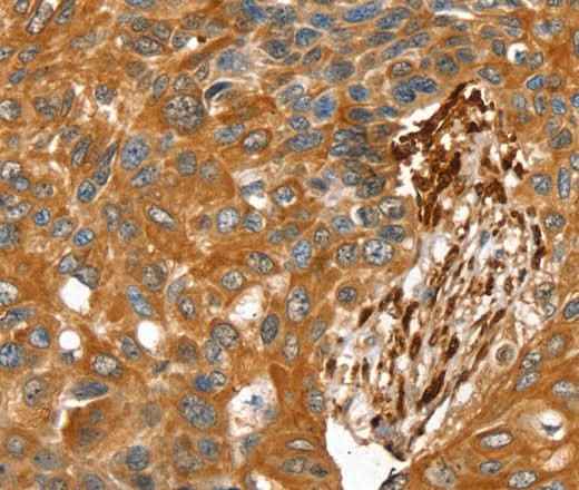Anti-Human/Rat TAGLN Antibody
