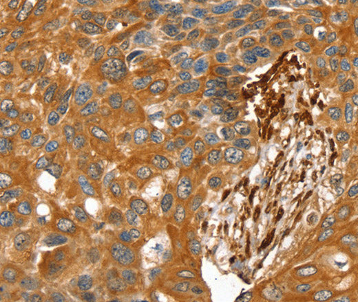 Anti-Human/Rat TAGLN Antibody - ABMIUM