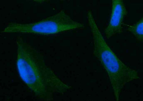 Anti-Human NAA10 Antibody [A1091] - ABMIUM