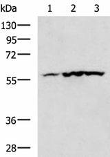 Anti-Human/Mouse/Rat CAMK2G Antibody - ABMIUM