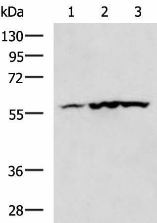 Anti-Human/Mouse/Rat CAMK2G Antibody - ABMIUM