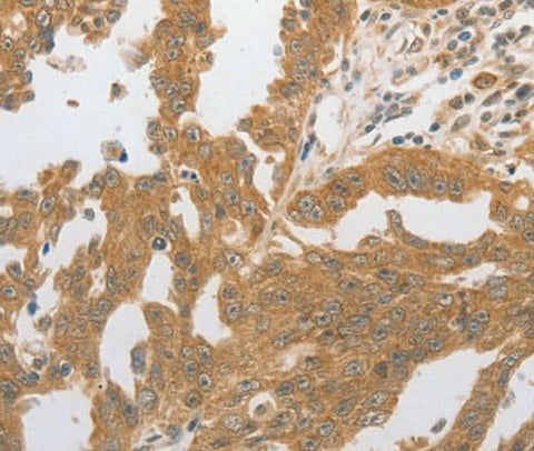 Anti-Human GRIN2C Antibody - ABMIUM