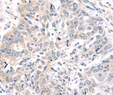 Anti-Human/Mouse ROR1 Antibody - ABMIUM