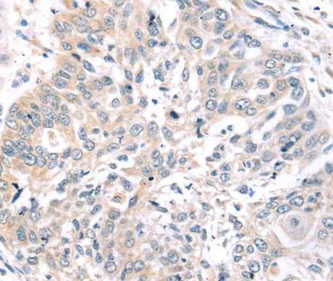 Anti-Human/Mouse ROR1 Antibody