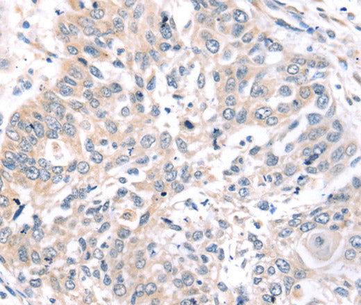 Anti-Human/Mouse ROR1 Antibody - ABMIUM