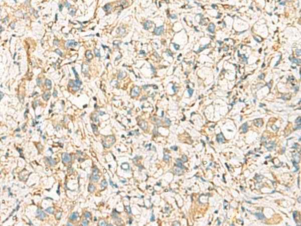 Anti-Human/Mouse IDS Antibody