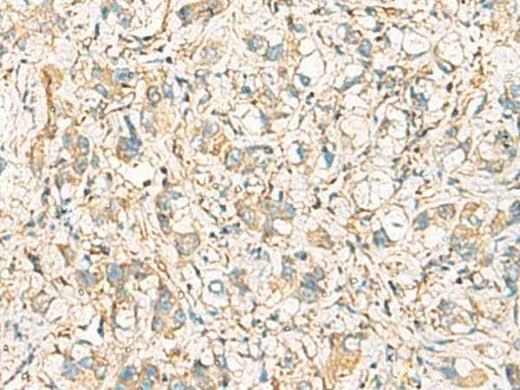 Anti-Human/Mouse IDS Antibody