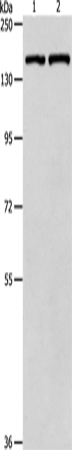 Anti-Human/Mouse PTCH1 Antibody - ABMIUM