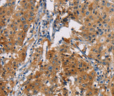 Anti-Human PDCD1LG2 Antibody - ABMIUM