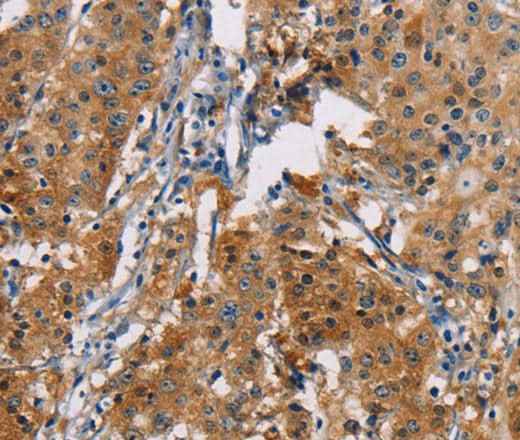 Anti-Human PDCD1LG2 Antibody