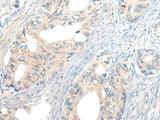 Anti-Human/Mouse NOG Antibody - ABMIUM