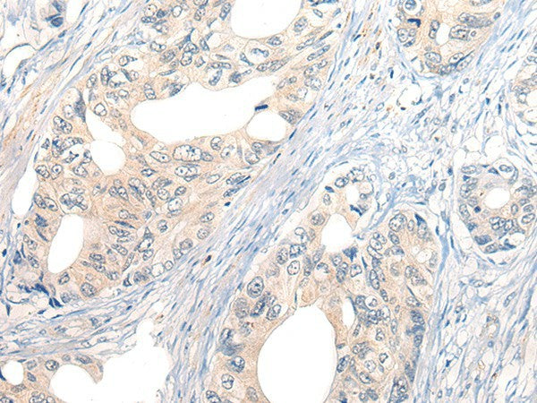 Anti-Human/Mouse NOG Antibody - ABMIUM