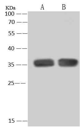 Anti-Human PCNA Antibody [B343] - ABMIUM