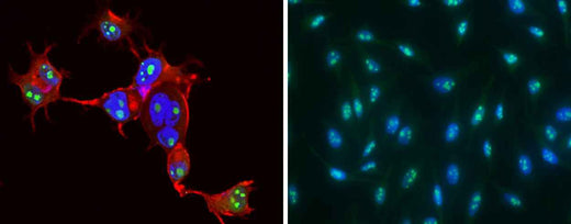 Anti-Human CCNE1 Antibody [A1044] - ABMIUM