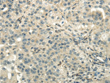 Anti-Human/Mouse/Rat DLAT Antibody - ABMIUM