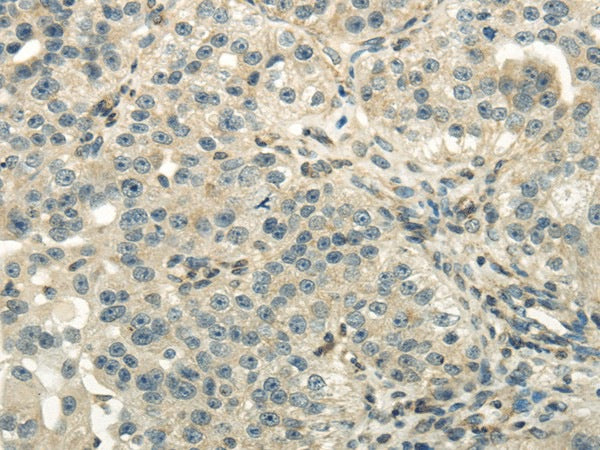 Anti-Human/Mouse/Rat DLAT Antibody - ABMIUM