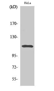 Western Blot analysis of Hela cells with Phospho-Stat2 (Tyr690) Polyclonal Antibody