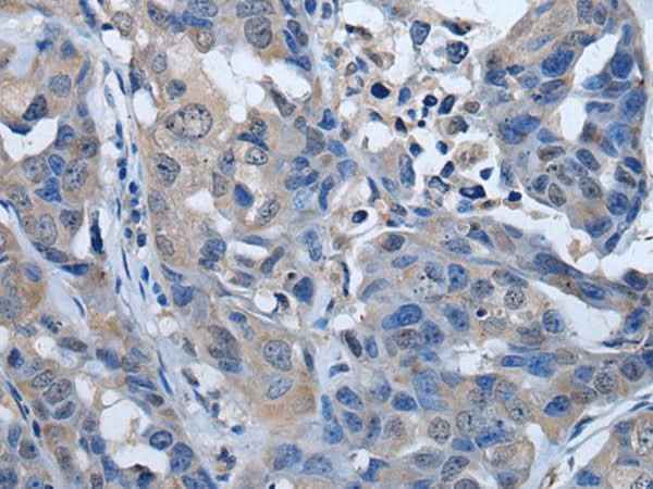 Anti-Human/Mouse/Rat PLK4 Antibody