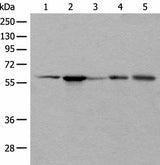 Western blot analysis of HEPG2 Hela A172 A549 and A431 cell lysates using BAIAP2L1 Polyclonal Antibody at dilution of 1:800