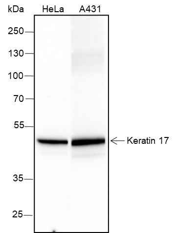 Anti-Human Keratin 17 Antibody [A275]