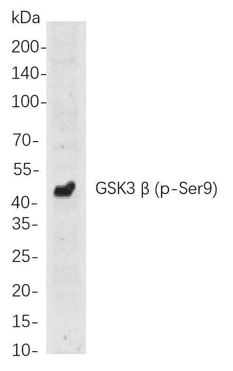 Anti-Human/Mouse GSK3 β Antibody [B816] - ABMIUM