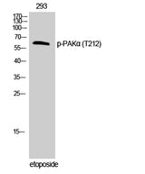 Western Blot analysis of 293T cells with Phospho-PAK1 (Thr212) Polyclonal Antibody